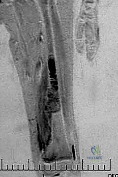 The diagnosis of fractures and principles of treatment