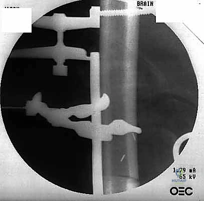 Clinical Image