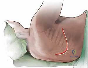 فحص سريري يوضح تقييم الأعراض العصبية للمريض في عيادة الدكتور محمد هطيف