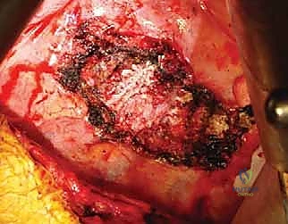 فريق طبي متكامل يعمل بتناغم داخل غرفة العمليات لضمان أفضل النتائج