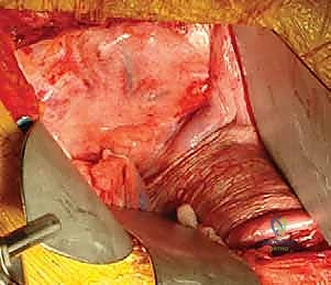 شرح مفصل للمريض حول تفاصيل العملية ونسب الأمان العالية