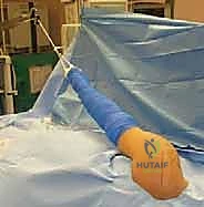 صورة توضيحية لـ إصلاح عدم استقرار الكتف الخلفي بالمنظار: دليل شامل للمرضى مع الأستاذ الدكتور محمد هطيف بصنعاء