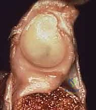 فحص التوجس السريري لمرضى الكتف