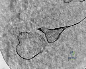 الاستعداد للتدخل الجراحي في غرفة العمليات