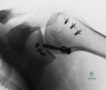 Clinical Image