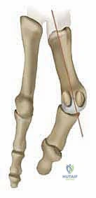 استخدام الأدوات الجراحية الدقيقة