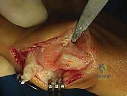 تجهيزات غرفة العمليات المتقدمة