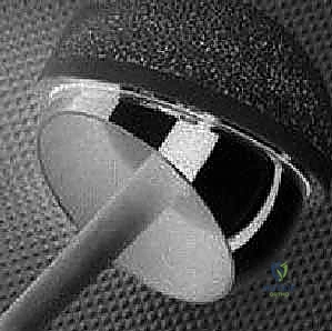 تثبيت المفصل الجديد