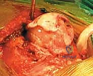 دقة متناهية في غرفة العمليات