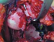 تجهيزات غرفة العمليات الحديثة