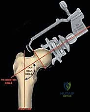 التأكد من ثبات الغطاء