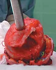 تحديد مستوى الألم