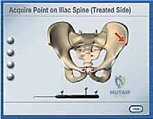 إرجاع المفصل لمكانه