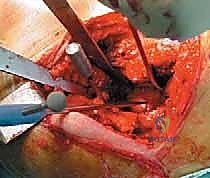 تقييم حالة فاطمة قبل الجراحة