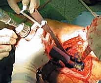 متابعة حالة أحمد في العيادة