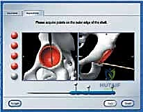صورة أشعة قبل وبعد الجراحة لأحمد