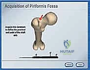تمارين تقوية عضلات الحوض