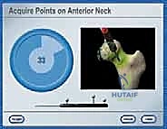 صورة توضيحية لـ استبدال سطح مفصل الورك: حل متطور لآلام الورك واستعادة النشاط مع الأستاذ الدكتور محمد هطيف