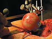 التخدير والمراقبة الحيوية