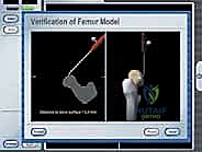 صورة شعاعية للنتيجة النهائية