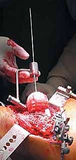 تعقيم وتجهيز منطقة الحوض