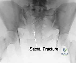 Clinical Image