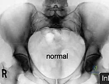 Clinical Image
