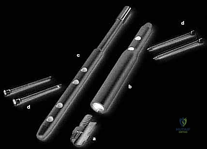 صورة طبية: دمج مفصل الركبة (تثبيت الركبة): الحل الأمثل للحالات المعقدة واستعادة الحركة في صنعاء مع الأستاذ الدكتور محمد هطيف