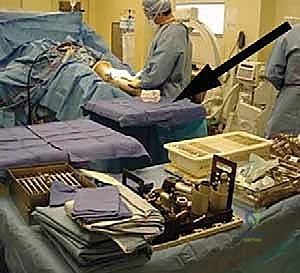 التشخيص الدقيق بالأشعة لحالات الركبة المعقدة