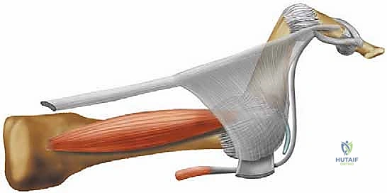 تطور تشوه إصبع المطرقة واختلال التوازن الوتري