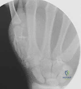 صورة شعاعية للأسلاك