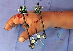 إغلاق الجرح التجميلي