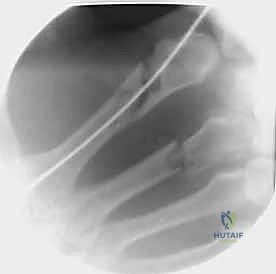 مقارنة العلاجات