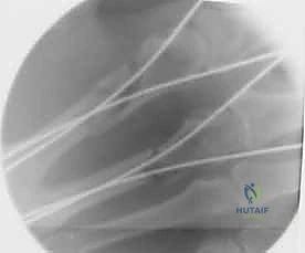 تمارين العلاج الطبيعي لليد