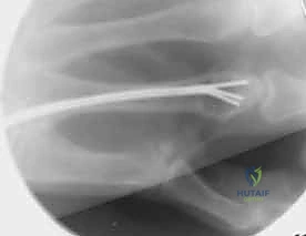 التأكد من المحاذاة بالـ C-arm