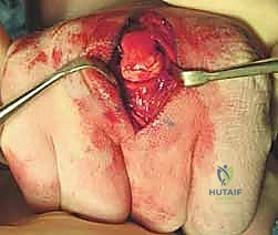 Clinical Image