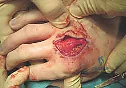 Clinical Image