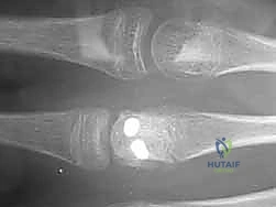 Clinical Image