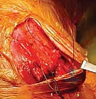 Clinical Image