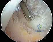Clinical Image