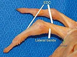 تشريح دقيق لإصبع اليد يوضح العلاقة وموضع الأربطة الجانبية والوتر الباسط المشترك للأصابع