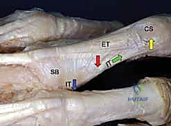 الوتر الطرفي يتكون من التقاء الأربطة الجانبية والرباط المثلثي
