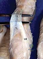 تشريح دقيق يوضح الوتر الباسط المشترك للأصابع مع الالتصاق الهام للوصلة المركزية