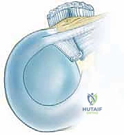 فحص سريري للركبة لتشخيص التمزق