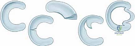 صورة توضيحية لتشريح الغضروف الهلالي ومناطق التروية الدموية