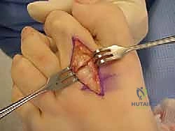 التشخيص بالأشعة السينية أثناء الوقوف