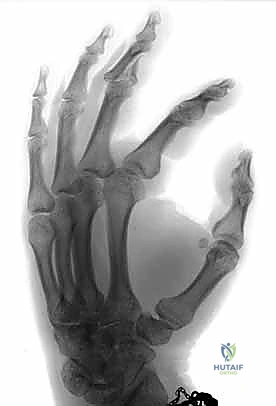 صورة مقربة للأسلاك المعدنية