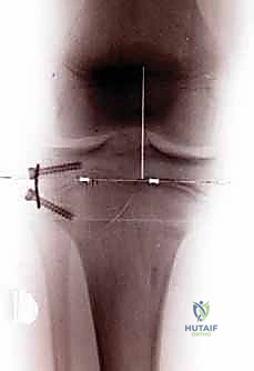 Clinical Image