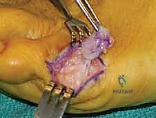 فحص أسباب تورم القدم