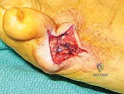 مقارنة العلاجات